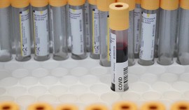 Иммунологическая память человека, переболевшего COVID-19, сохраняется  минимум 8 месяцев