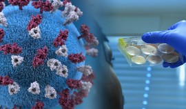 За прошедшие сутки в Чеченской Республике зарегистрировано 10 случаев COVID-19