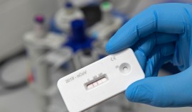 В России за сутки проведено 402 тыс. тестов на выявление коронавирусной инфекции COVID-19