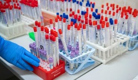 В России провели более 81 миллиона тестов на COVID-19