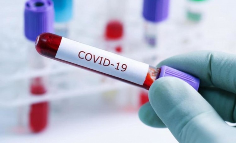 Заболеваемость COVID-19 в РФ снизилась на 20% за неделю